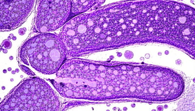 Illustration of scientific research advancements in pancreatic cancer